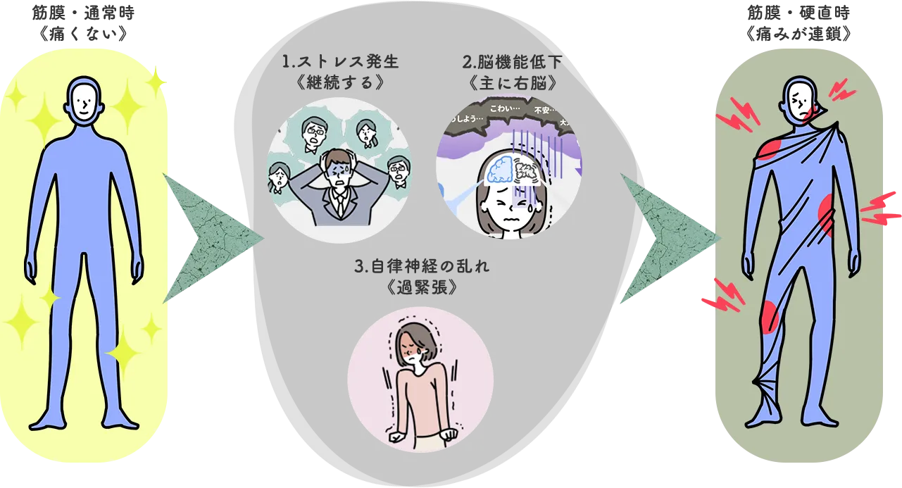 ストレスが筋膜を硬くし、痛みや可動制限に繋がる流れの図解